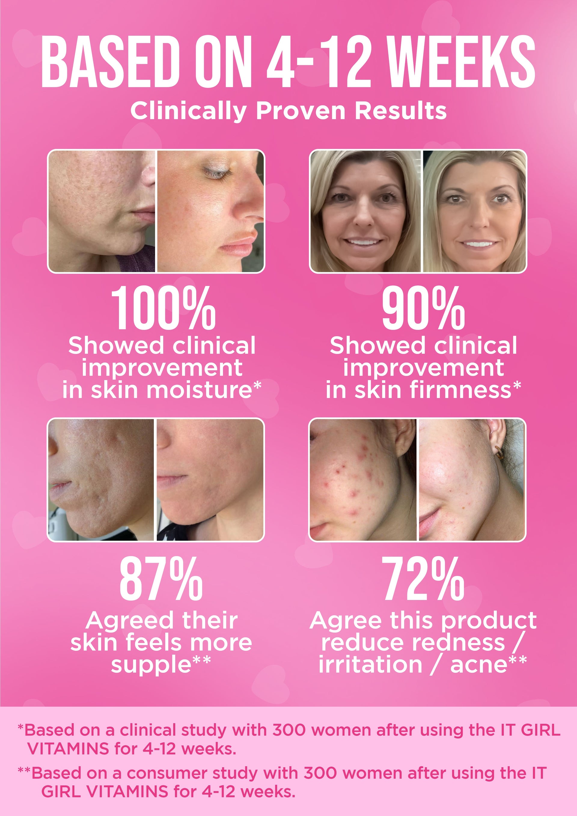 It Girl Skin – Skin Food