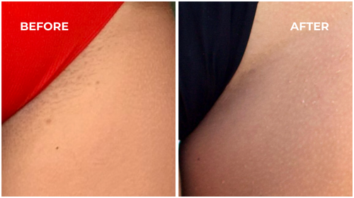 Bikini Oil