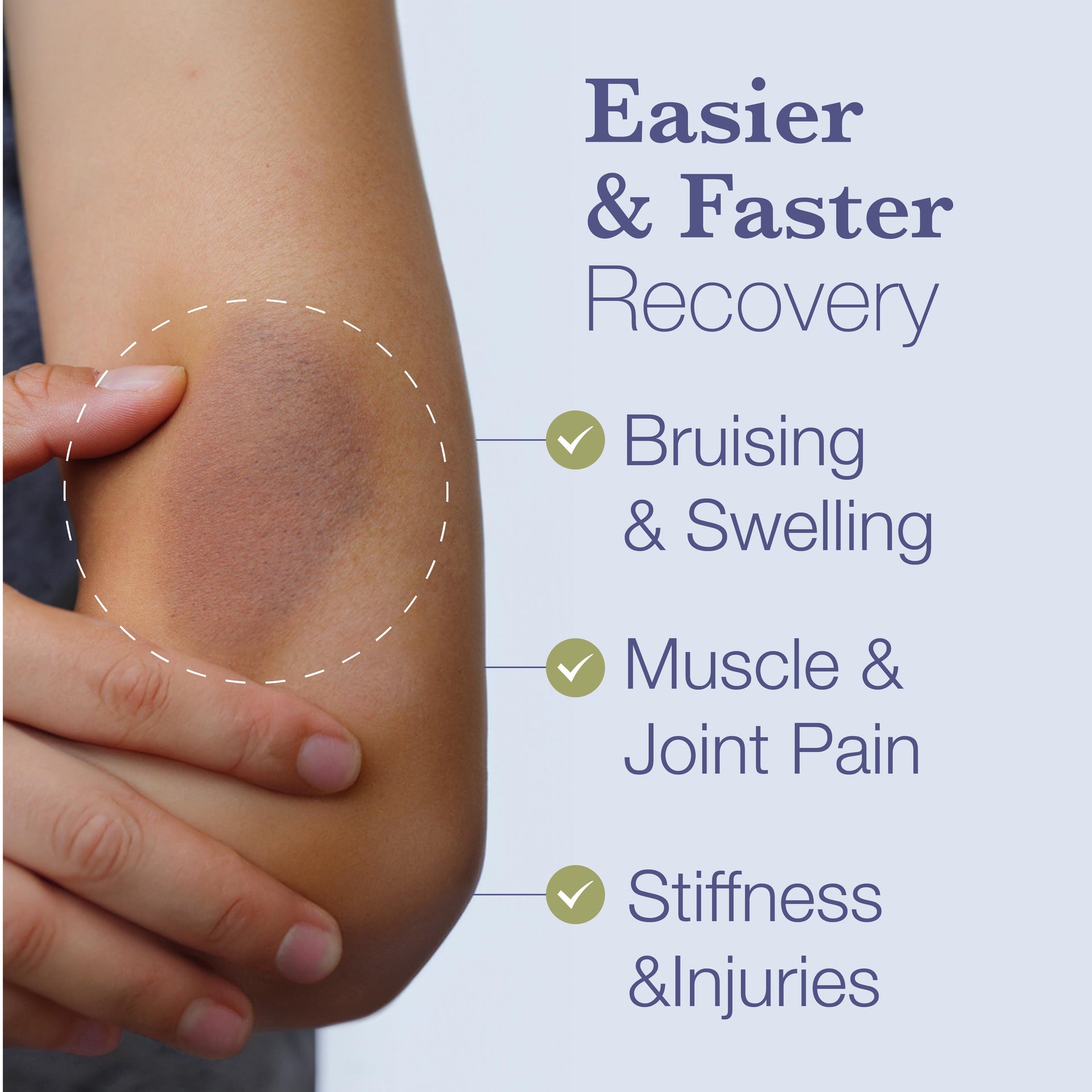 BruiseMD Topical Bruise Gel With Arnica and Caffeine