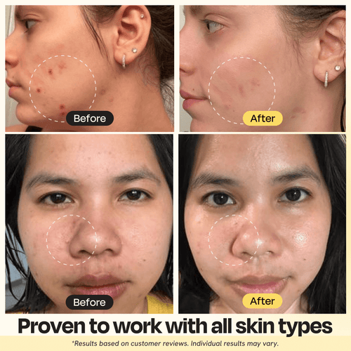 Vitamin C Clay Mask