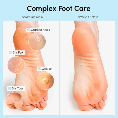 Exfoliating & Hydrating Foot Mask