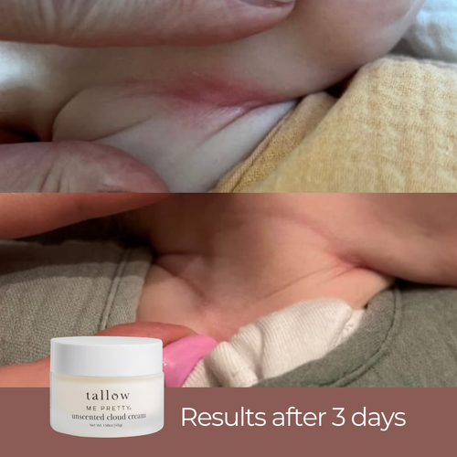 Unscented Cloud Cream